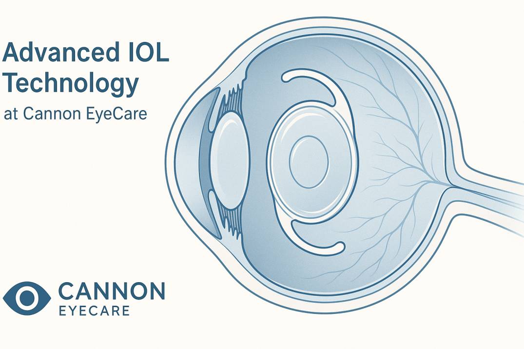 Intraocular Lenses at Cannon EyeCare Seattle