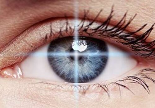 Considering Laser Vision Correction