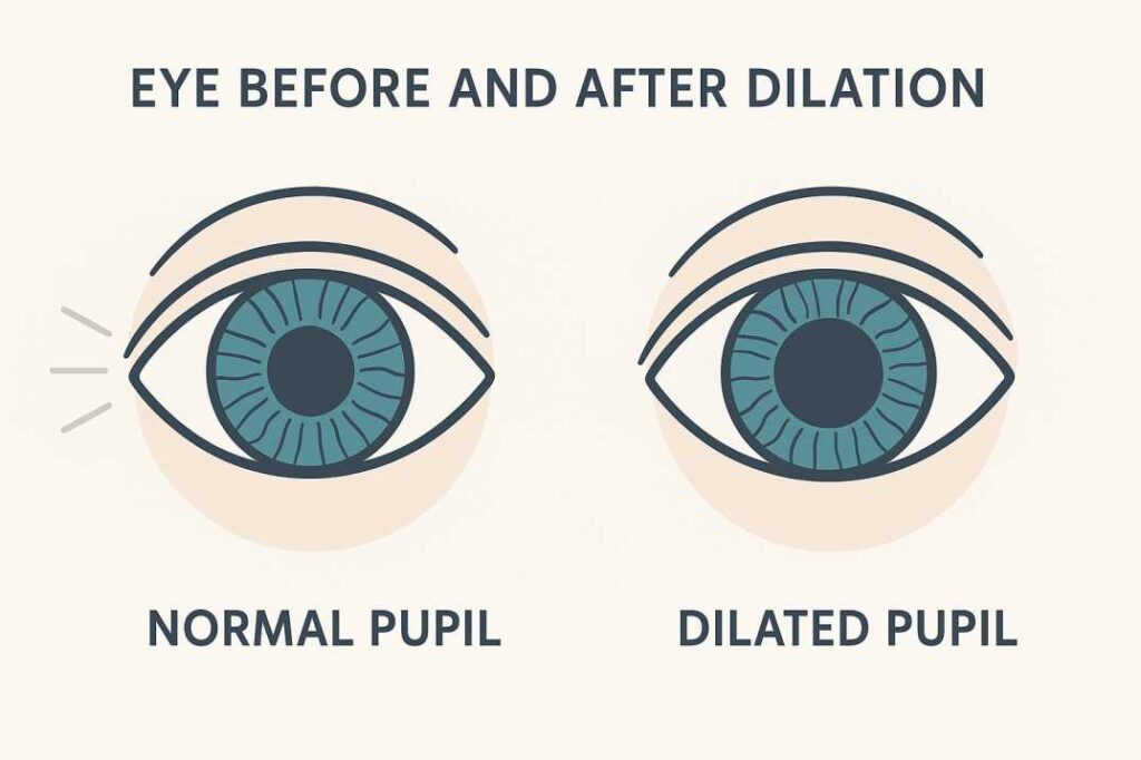 Before and after illustration of pupil dilation with labeled anatomy.