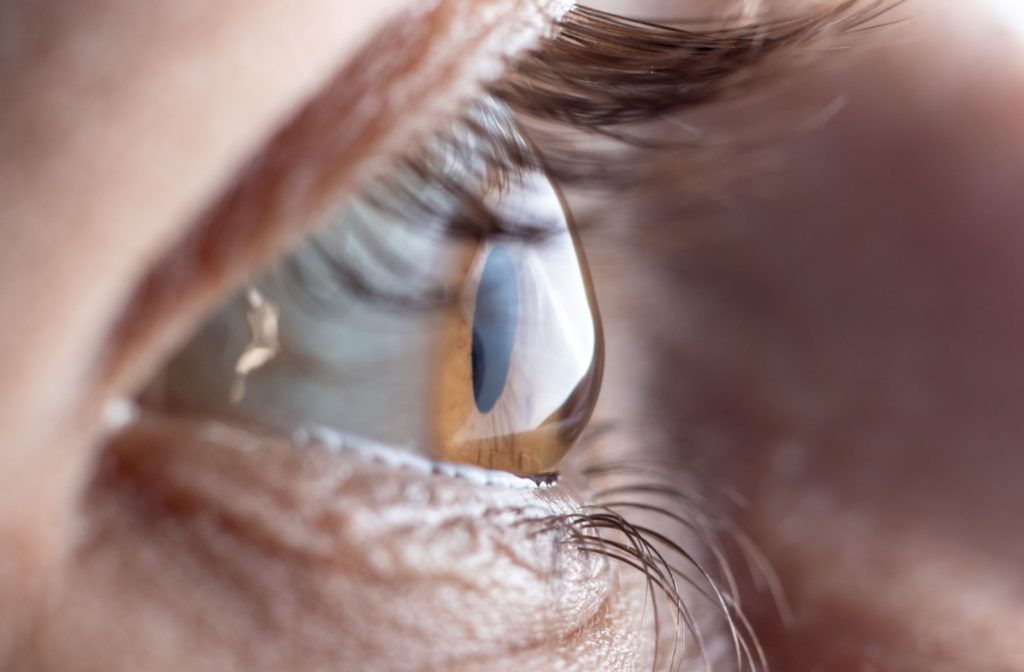 Can-You-Wear-Contacts-with-Astigmatism_-Supporting-1024x672